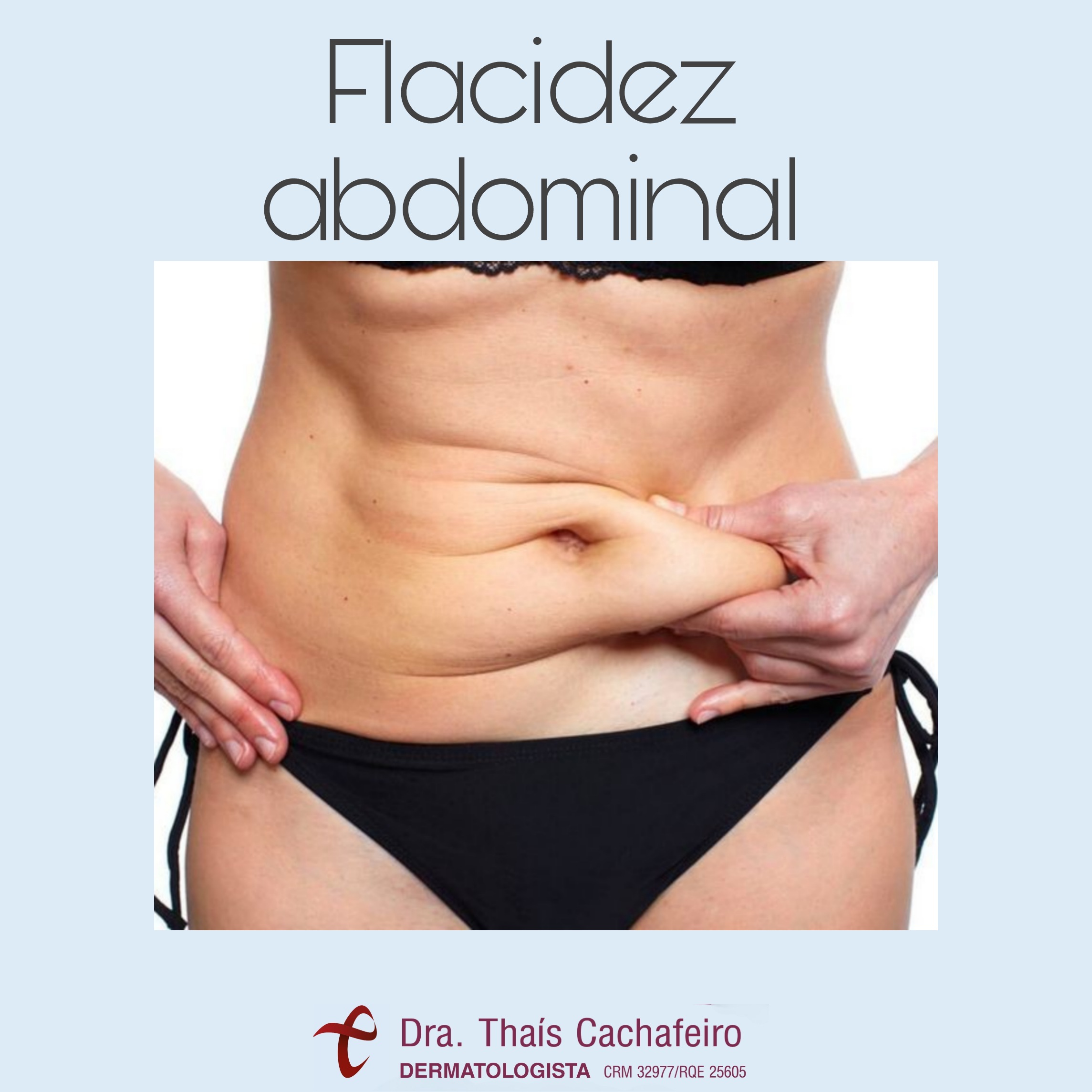 Flacidez Abdominal